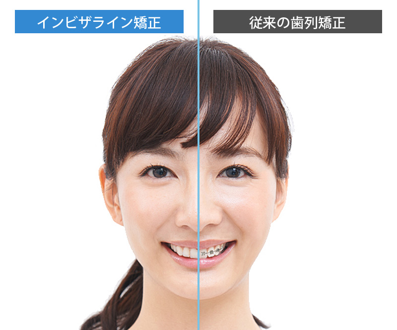 従来の歯列矯正治療との違い